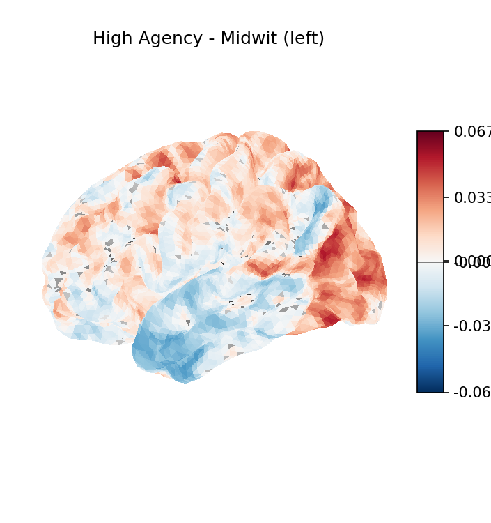 HA minus Midwit, left
